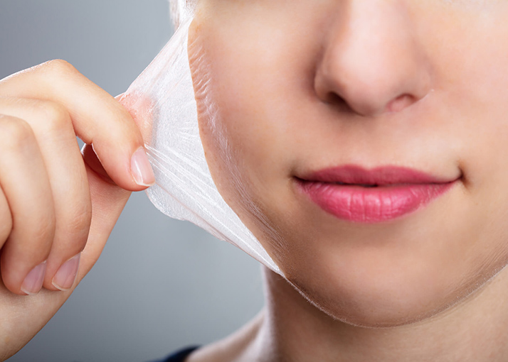 Peeling Químico